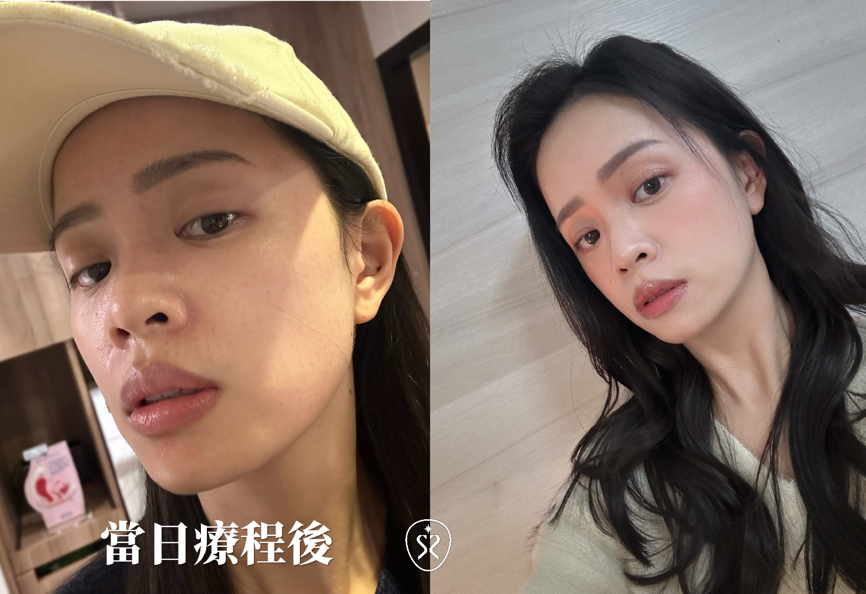 【修秘水光】